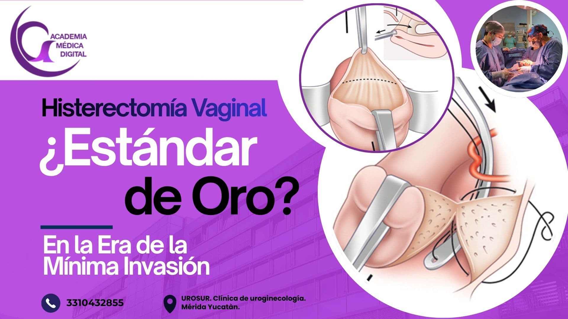 HISTERECTOMIA VAGINAL: ¿Estándar de Oro en la Era de la Mínima Invasión?  