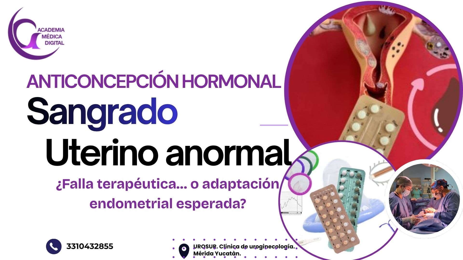 SANGRADO UTERINO ANORMAL ASOCIADO A ANTICONCEPCIÓN HORMONAL: ¿Falla terapéutica… o adaptación endometrial esperada? 