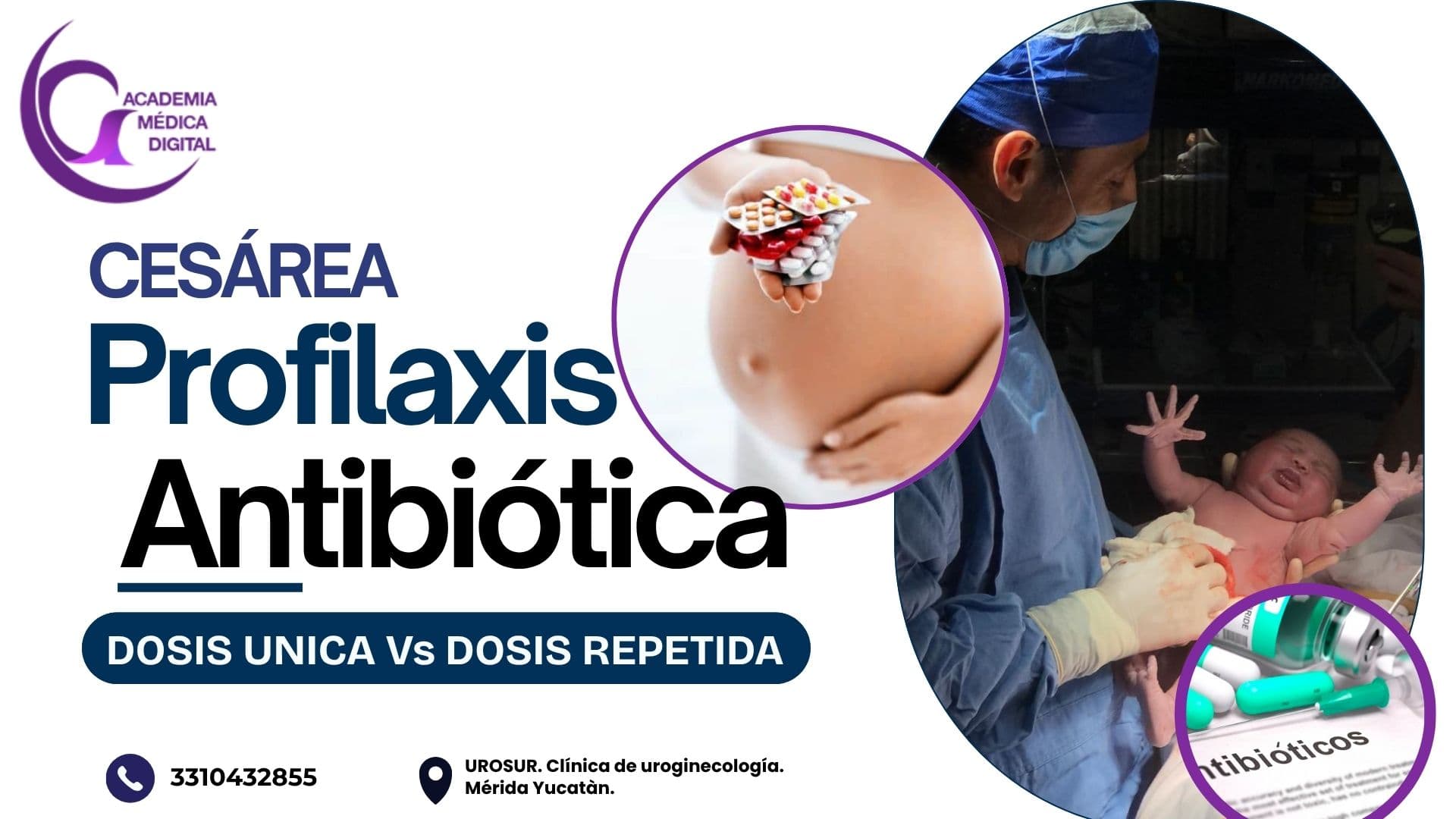 PROFILAXIS ANTIBIÓTICA EN CESÁREA: Dosis única Vs dosis repetida