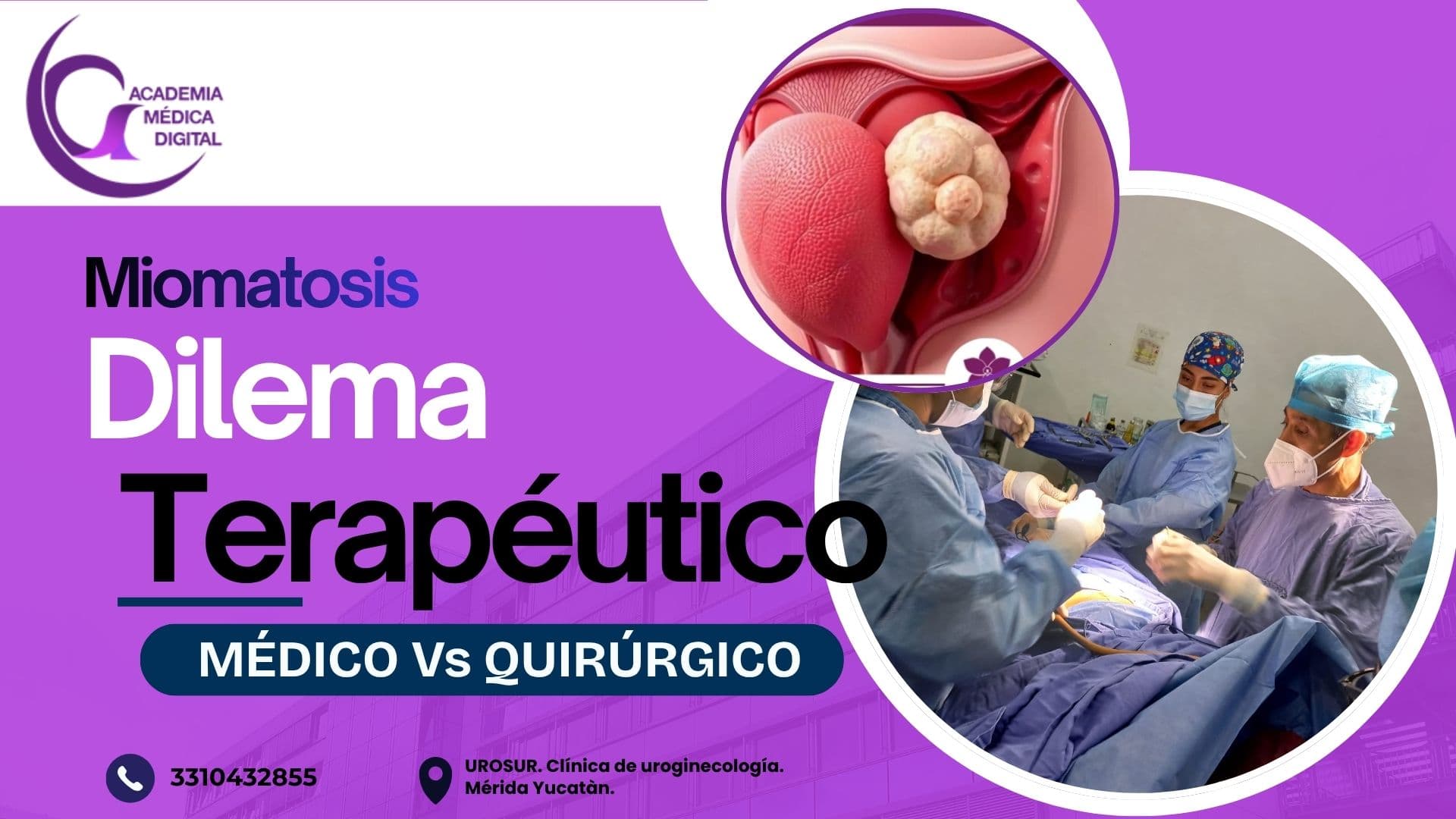 MIOMA UTERINO SINTOMÁTICO: Manejo médico Vs Quirúrgico