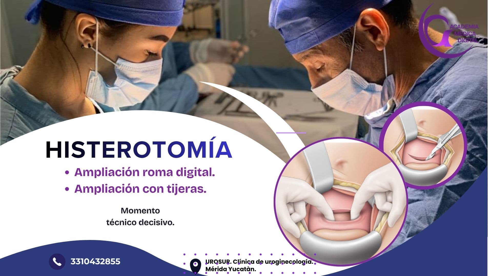 HISTEROTOMIA:  Ampliacion roma vs con tijeras